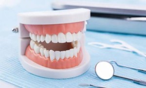 拥有自信笑容的第一步牙齿矫正，牙齿矫正大概要花费多少钱？